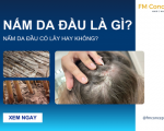 NẤM DA ĐẦU LÀ GÌ? CÓ NGUY HIỂM HAY KHÔNG?