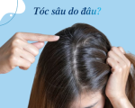 Tóc sâu là gì? Tại sao tóc sâu gây ngứa và có nên nhổ không?
