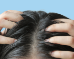 Tóc bết ở đỉnh đầu: Nguyên nhân và cách xử lý hiệu quả