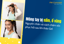 Móng tay bị nấm, ố vàng: Nguyên nhân và cách chăm sóc phục hồi sau khi tháo Gel