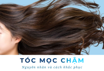 Tại sao tóc mọc chậm? Nguyên nhân và giải pháp giúp tóc phát triển khoẻ mạnh