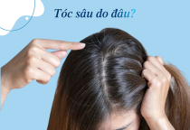 Tóc sâu là gì? Tại sao tóc sâu gây ngứa và có nên nhổ không?