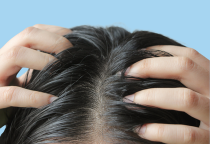 Tóc bết ở đỉnh đầu: Nguyên nhân và cách xử lý hiệu quả