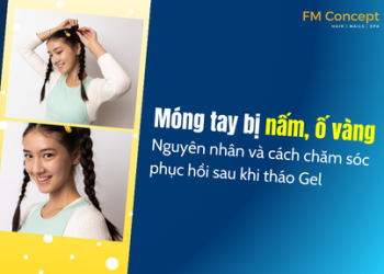 Móng tay bị nấm, ố vàng: Nguyên nhân và cách chăm sóc phục hồi sau khi tháo Gel
