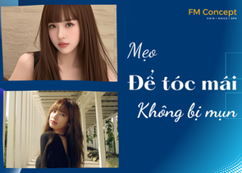 8 BÍ KÍP ĐỂ TÓC MÁI MÀ KHÔNG LO BỊ MỤN Ở TRÁN