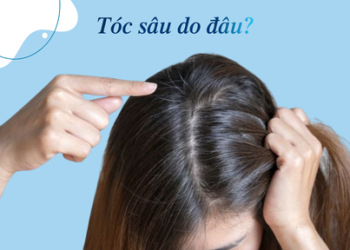Tóc sâu là gì? Tại sao tóc sâu gây ngứa và có nên nhổ không?