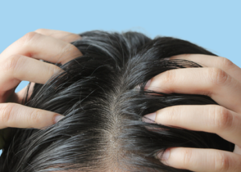 Tóc bết ở đỉnh đầu: Nguyên nhân và cách xử lý hiệu quả