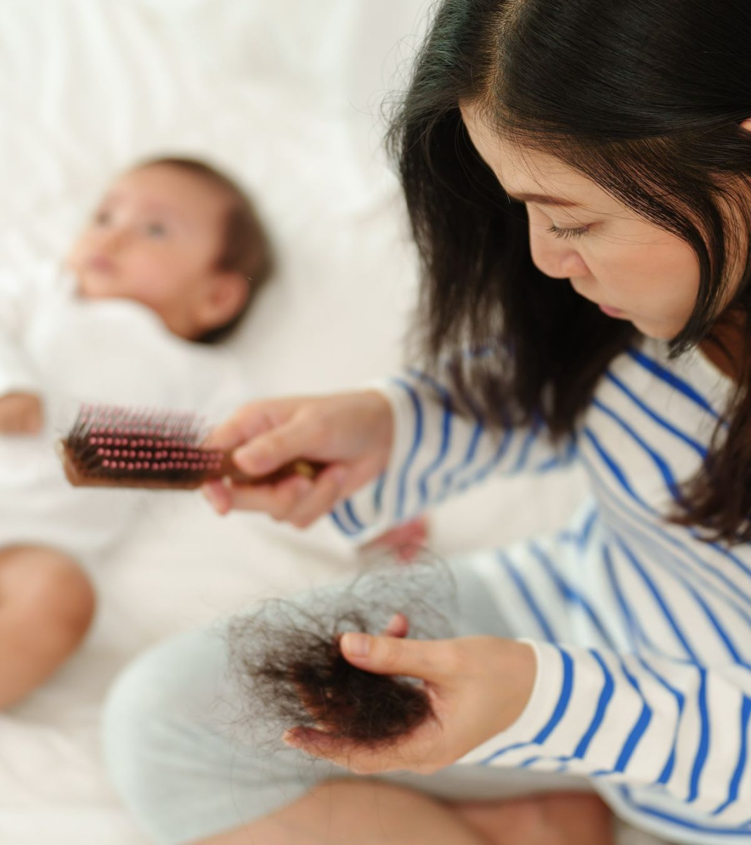 mẹ bỉm bị rụng tóc sau sinh